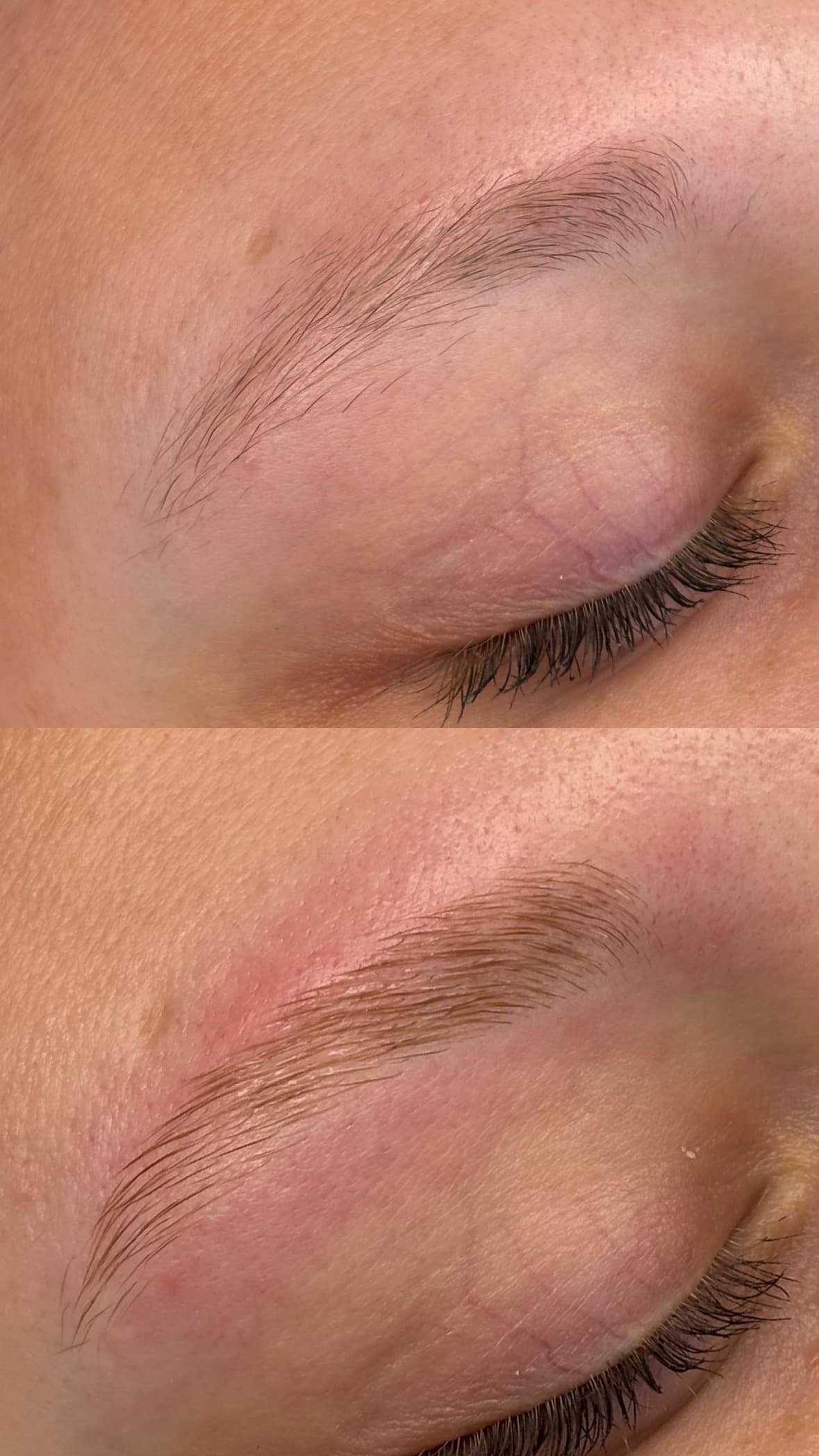 Augenpaket — Bild 3